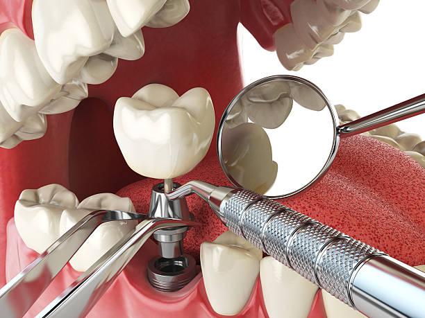 Best Emergency Dental Surgery in Difficult Run, VA